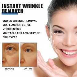 West & Month Retinol Wrinkle Removal Cream