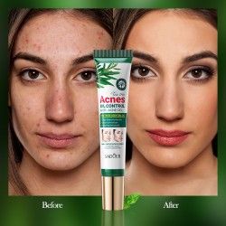 Facial gel Sadoer Acnes Oil Control Tea Tree